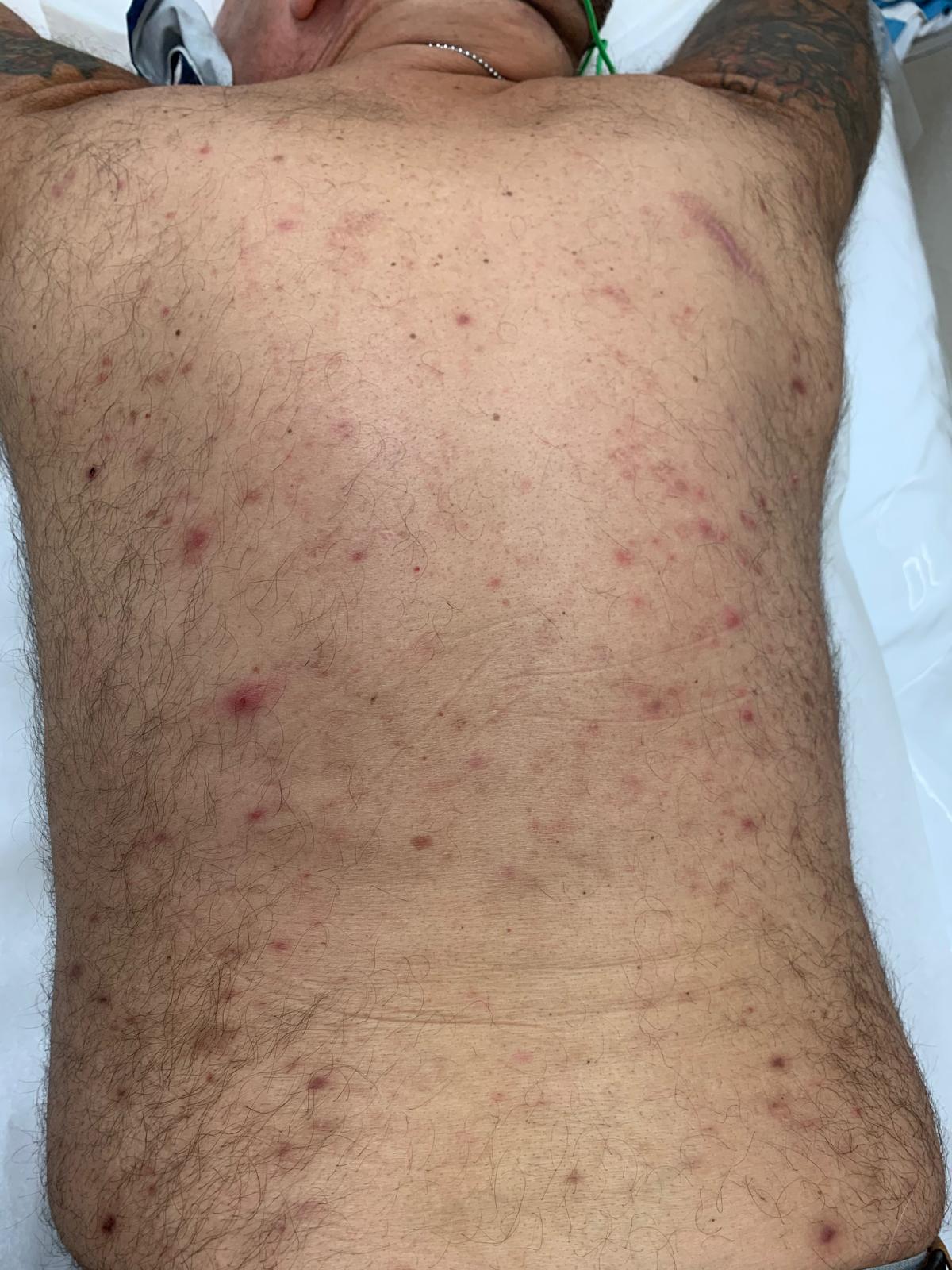 Before Brazilian wax treatment, example 4